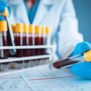 Featured image for a blog post titled 'Blood Work for Understanding Hair Loss' from Alopecia & Beyond, dated March 13, 2024. Depicts a healthcare professional in a lab coat handling test tubes filled with blood samples, suggesting a clinical approach to diagnosing hair loss causes.